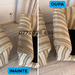 Curatare tapiterie Bucuresti, canapele, saltele, auto